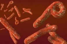 ebola-virus-2