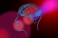 AVC accident vascular cerebral