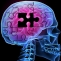 alzheimer