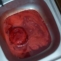 sange contaminat