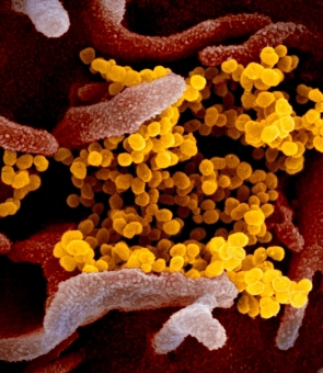 coronavirus