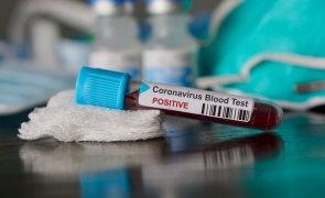 coronavirus test sange