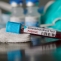 coronavirus test sange