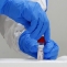 test coronavirus COVID