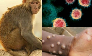 variola maimutei 