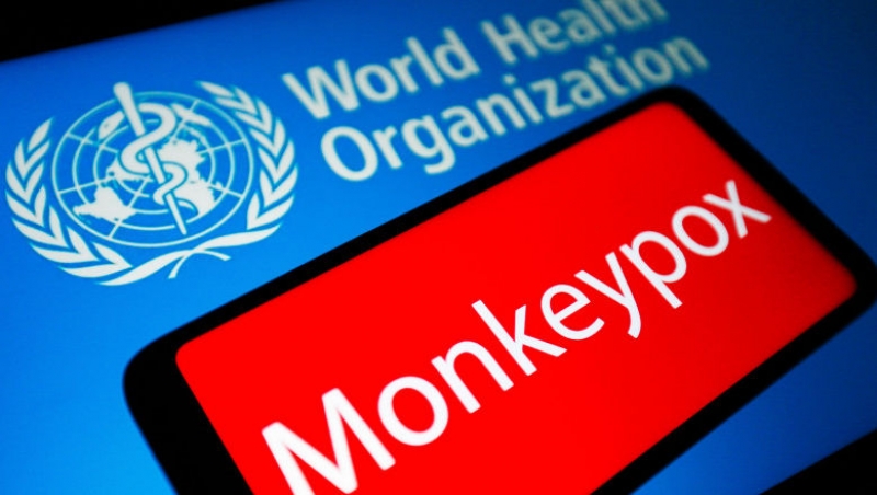 Three new cases of monkeypox, diagnosed in Romania