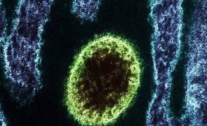 henipavirus